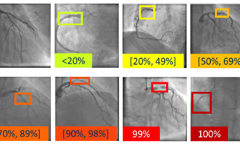 Más de 6.000 imágenes para apoyar el diagnóstico de enfermedades cardiovasculares