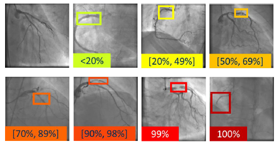 Más de 6.000 imágenes para apoyar el diagnóstico de enfermedades cardiovasculares